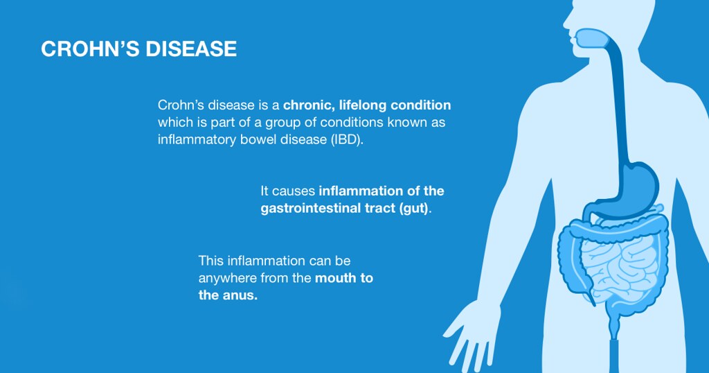 ozempic and crohn's disease
