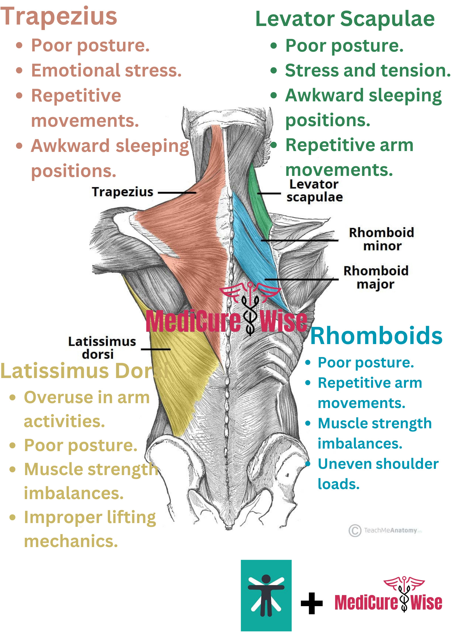 The Ultimate Back Pain Location Chart - MediCure Wise