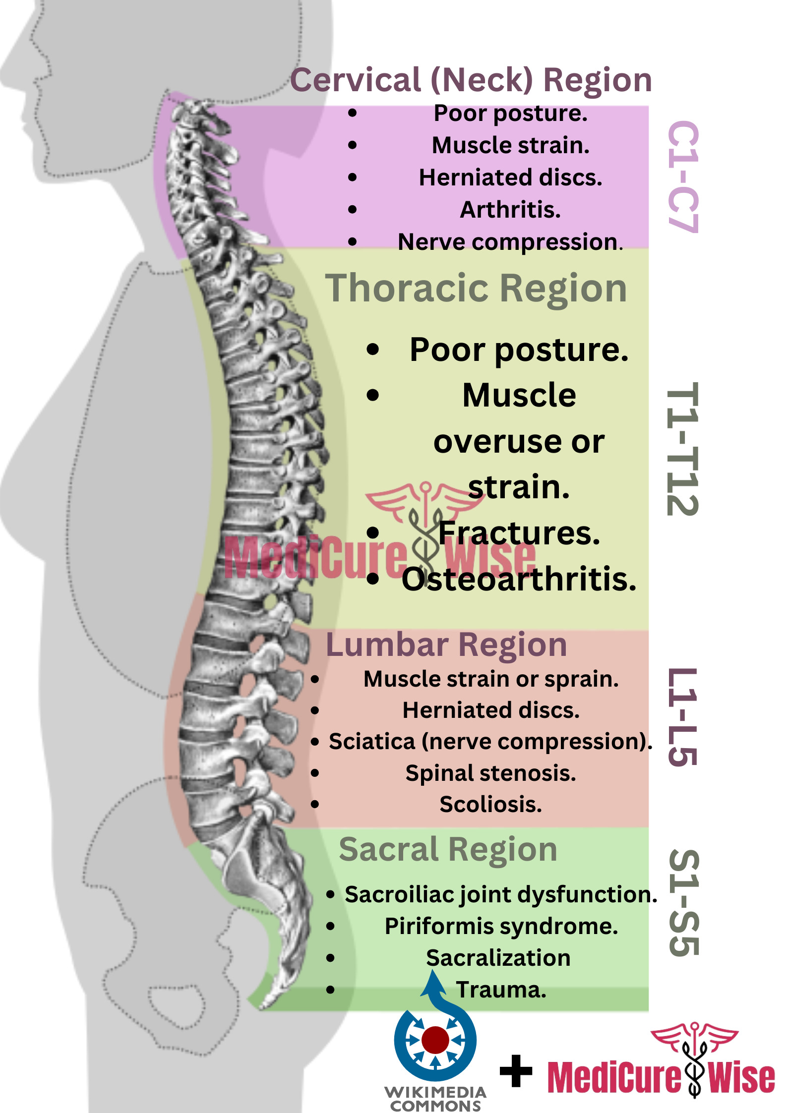 The Ultimate Back Pain Location Chart - MediCure Wise